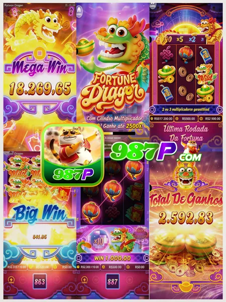 987P